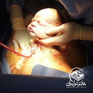 خطرات و عوارض زایمان زودهنگام و دیرهنگام خطرات و عوارض زایمان زودهنگام و دیرهنگام